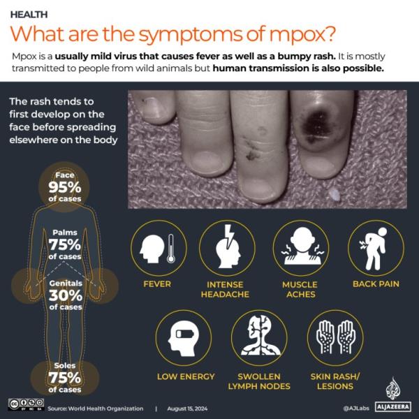 INTERACTIVE_MPOX August 19_2024_signs and symptoms REVISED
