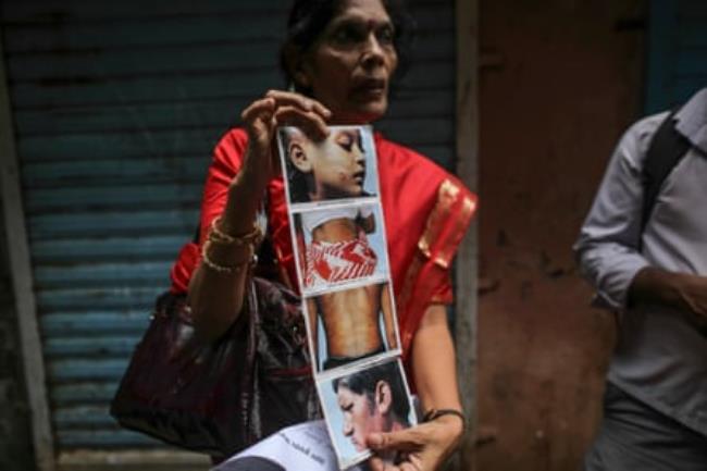 A woman holds photos of people with leprosy.