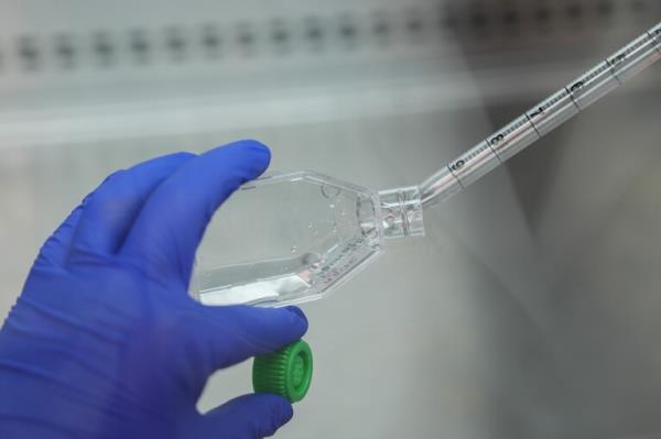 Bivek Timalsina prepares lung tissue samples that will be used in research on aerosolized microcystin, algae toxins when they become airborne, Thursday, Sept. 5, 2024, at the University of Toledo in Toledo, Ohio. (AP Photo/Joshua A. Bickel)