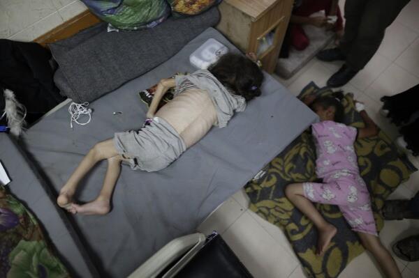FILE - Hana Al-Rai, 3, left, who suffers from diabetes, a weakened immune system and malnutrition, rests at Al-Aqsa Martyrs Hospital in Deir al-Balah in the central Gaza Strip, wher<em></em>e she is receiving treatment, on June 1, 2024. (AP Photo/Jehad Alshrafi, File)