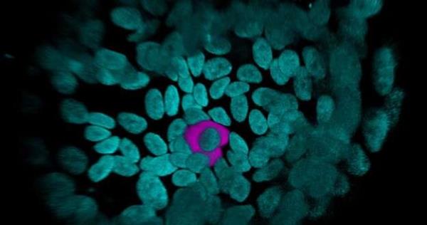 Gut instincts: Intestinal nutrient sensors