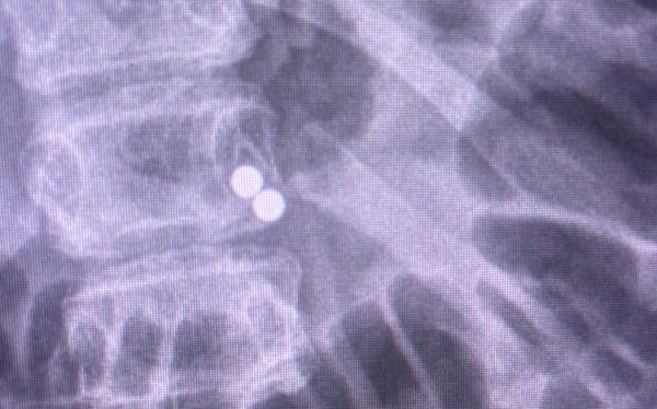An X-ray of the magnets.