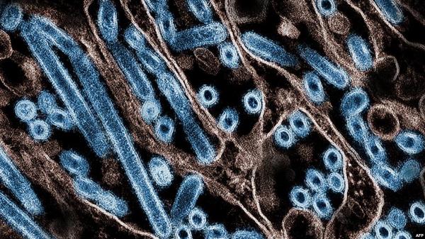 FILE - This image obtained Nov. 22, 2024, courtesy of the Centers for Disease Co<em></em>ntrol and Prevention and the Natio<em></em>nal Institute of Allergy and Infectious Diseases, shows a colorized electron micrograph of bird flu cells (in blue). 